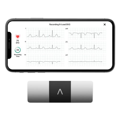 Elettrocardiogramma a domanda — immagine 1